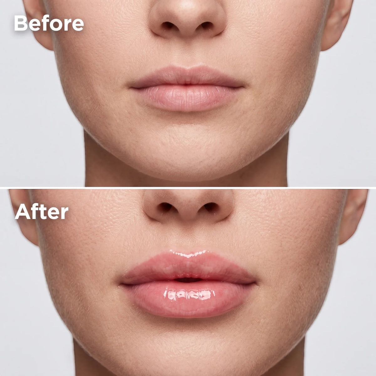 extreme lip plumper